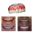 Dentadura Temporária Ajustável em Silicone Flexível