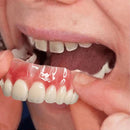 Dentadura Temporária Ajustável em Silicone Flexível